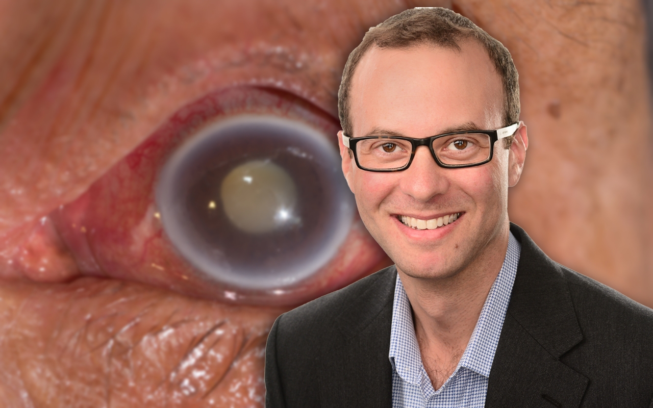 Glaucoma20podcast