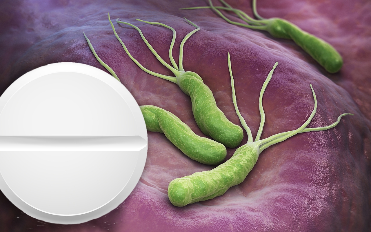 Aspirin, H pylori and UGI bleeding, with Dr Justin Ng