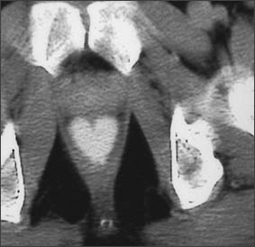 X-ray image