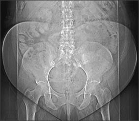 X-ray image