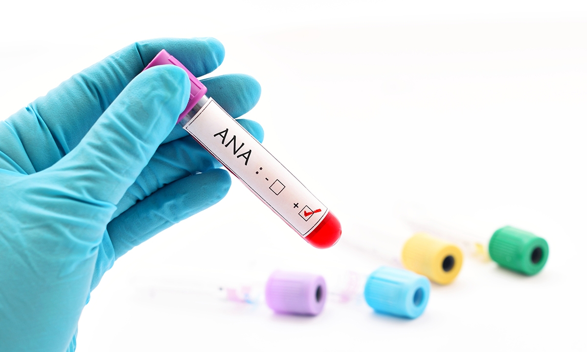 Mja2 12103