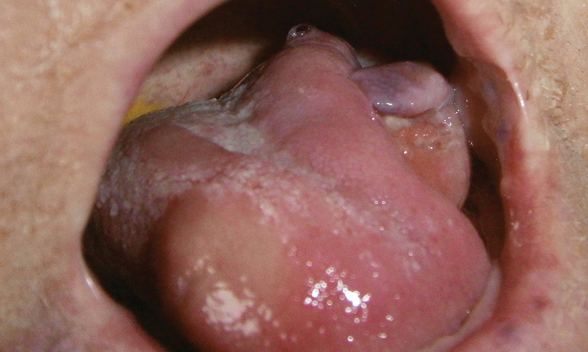Mja2 50298