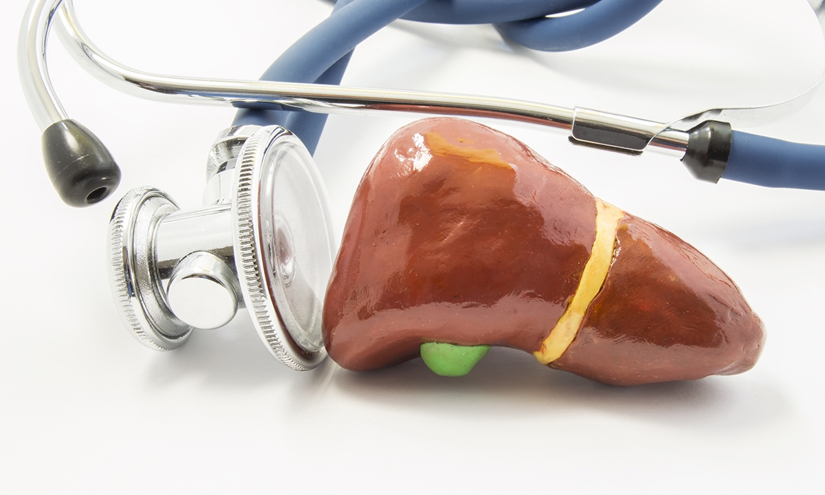 Mja2 50483