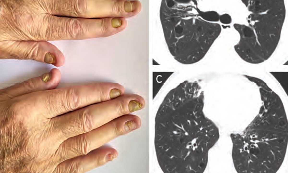 Mja2 50807