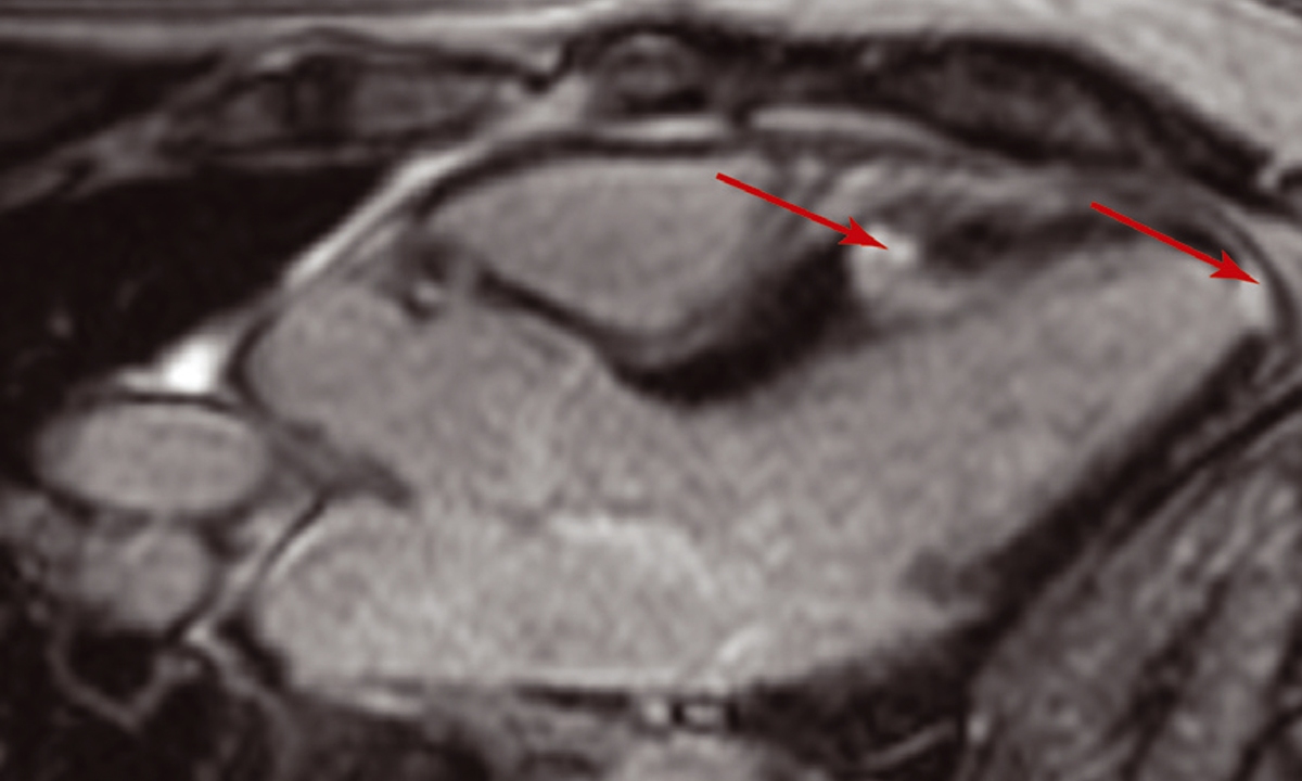 Mja2 51140