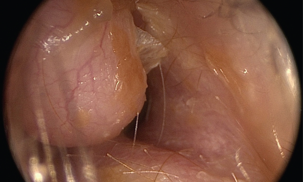 Mja2 51496