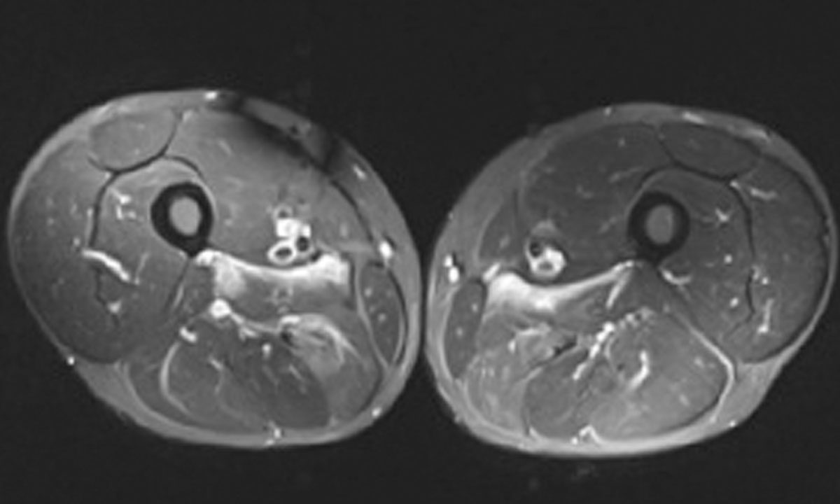 Mja2 51609
