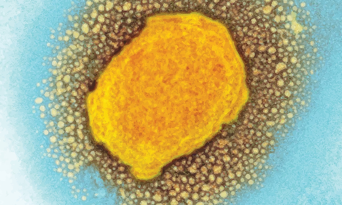 Mja2 51647