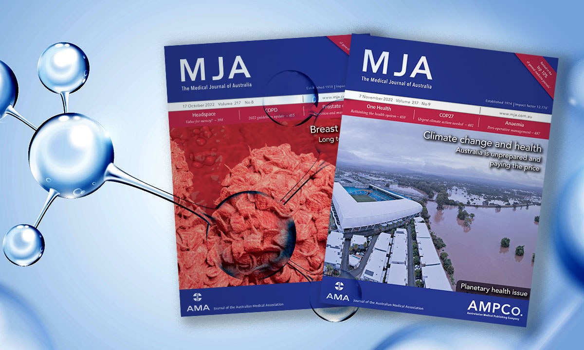 Mja2 51801