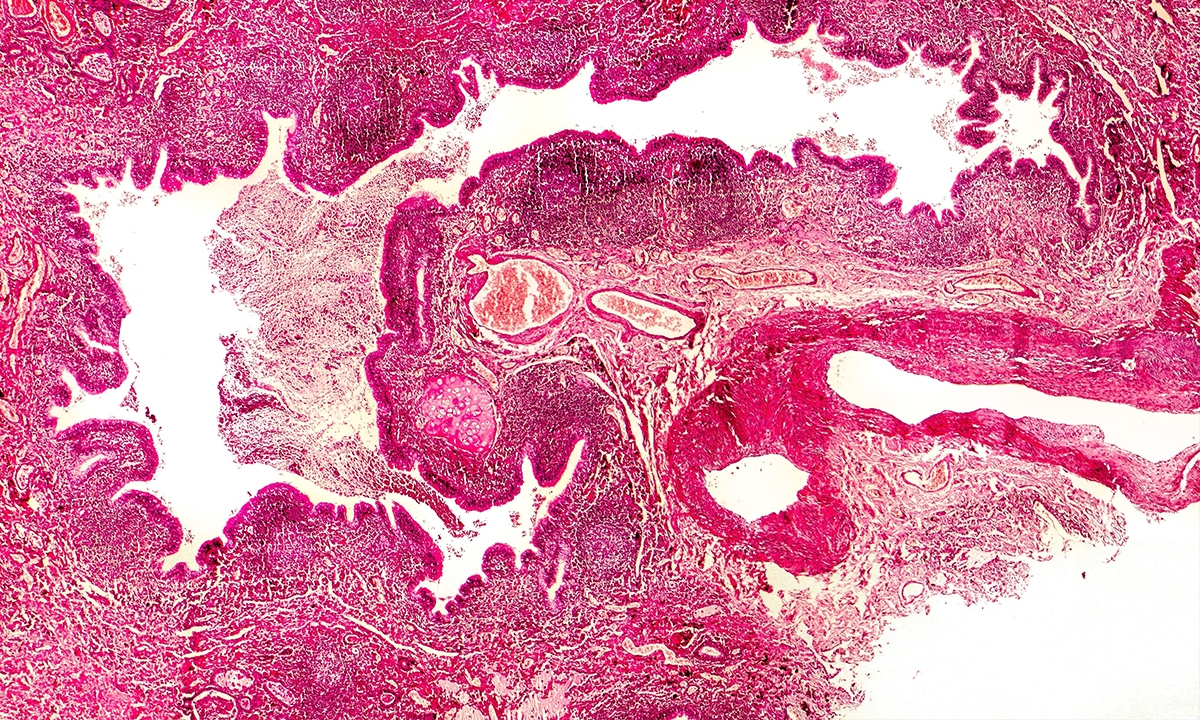 Mja2 52160