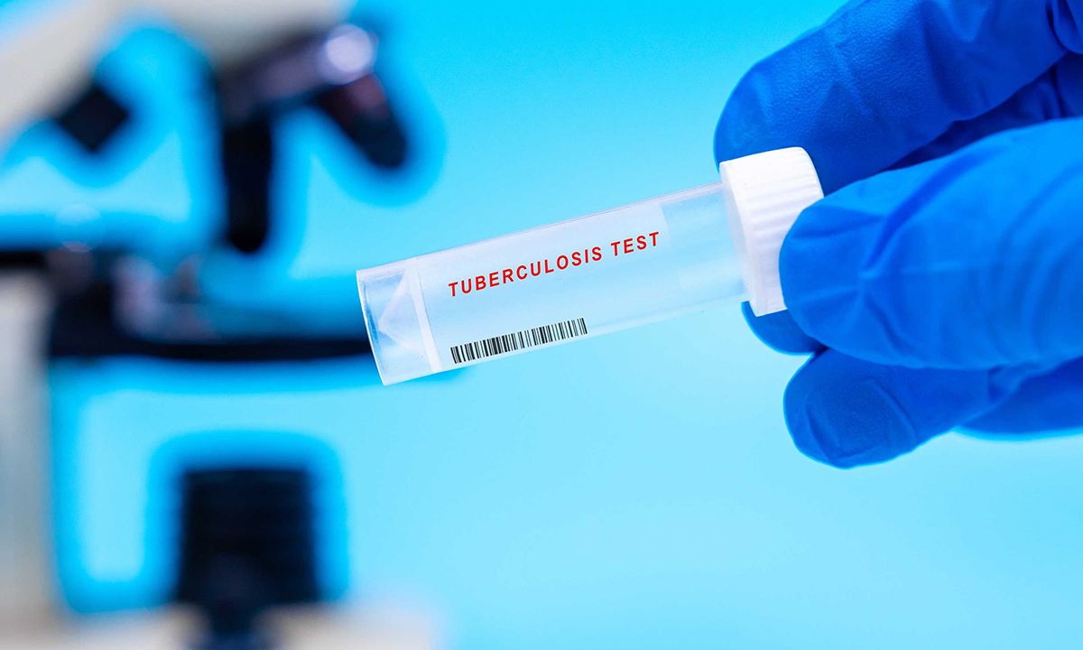 Not Gone but Often Forgotten: Action Needed to Address Tuberculosis in Aboriginal and Torres Strait Islander Communities