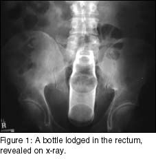 Image of x-ray