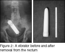 Image of x-ray