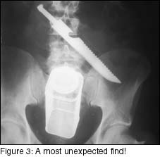 Image of x-ray