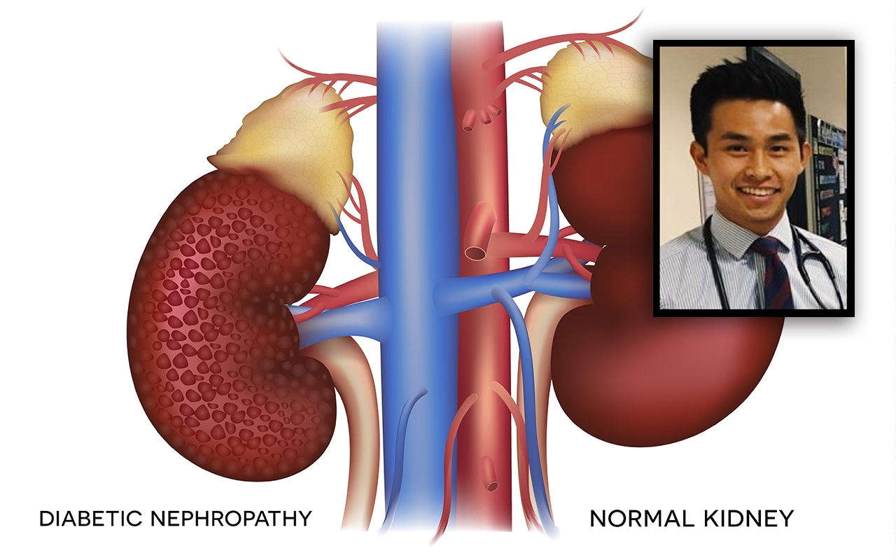 Cardiovascular risks with diabetes and chronic kidney disease, with Dr Brendon Neuen