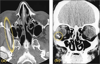 X-ray images