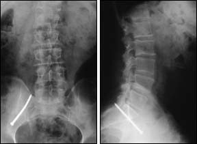 X-ray images