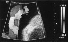 X-ray image
