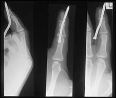 X-ray image