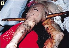 Injury image