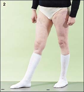 Post-injury image