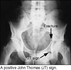 Image of x-ray