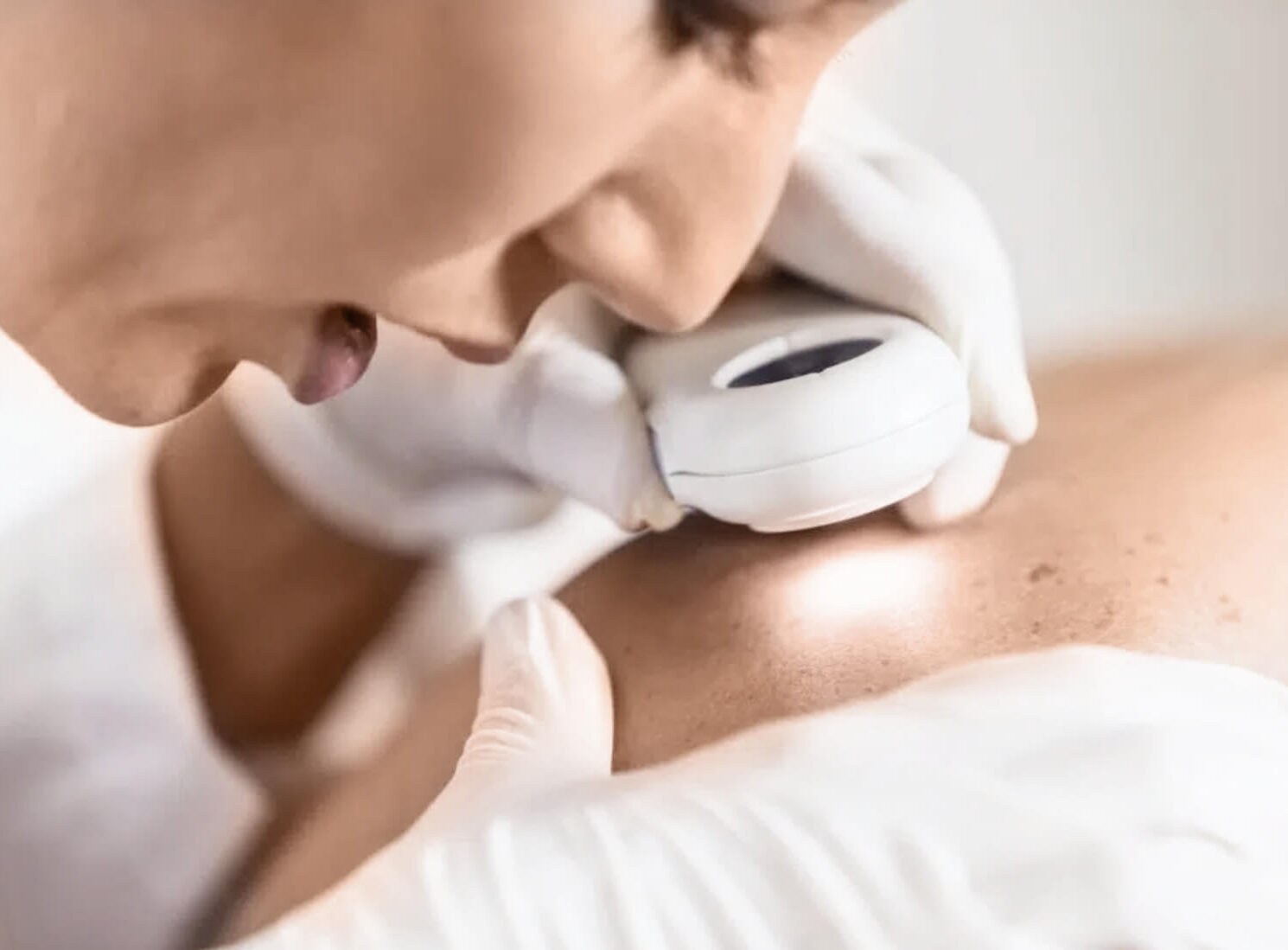 Auf dem Bild ist Dermacares neue Dermatologin in Wien zu sehen wie sie eine Hautkrebsvorsorge durchführt. Dr. Alica Píšteková untersucht mit einer speziellen Lupe ihre Patientin.