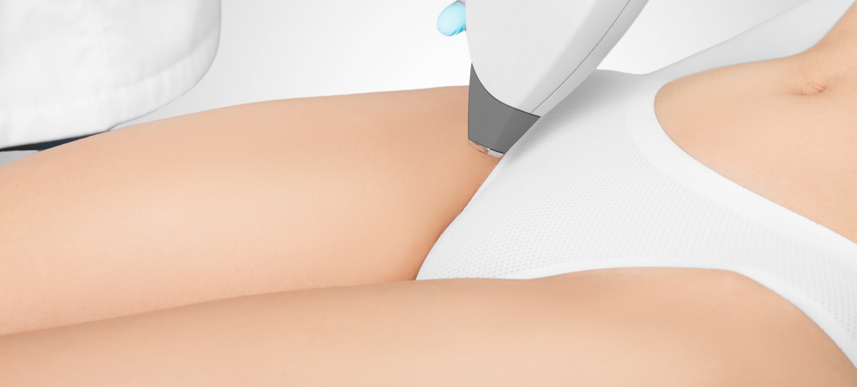 Das Bild zeigt eine Laserbehandlung an der Bikinizone, bei der der hochmoderne Inwave 4-Laser von Spectra zum Einsatz kommt. Dermacare Wien nutzt diese fortschrittliche Technologie, um im Intimbereich Haarentfernung sanft, präzise und nahezu schmerzfrei durchzuführen. Der Inwave 4-Laser ist speziell für empfindliche Haut geeignet und sorgt für dauerhaft glatte Ergebnisse.