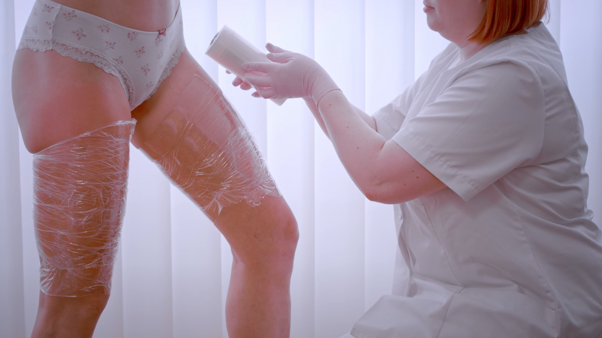 Cellulite Behandlung in Wien bei Dermacare