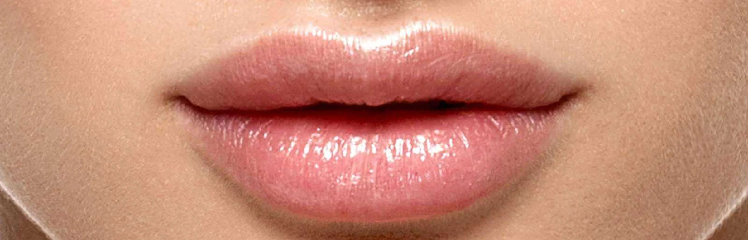 Lippen aufspritzen ohne künstlich auszusehen?