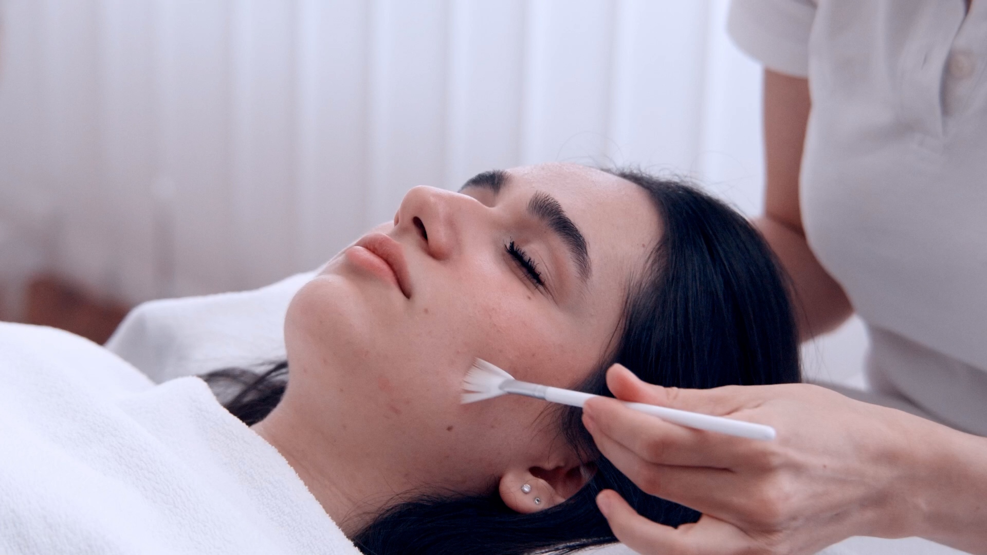 TCA-Peeling für eine strahlende Haut