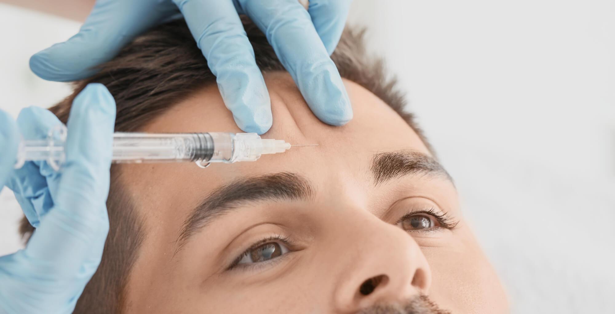 Hier ist ein Mann zu sehen der in seine Stirn eine Methode zur Faltenunterspritzung bekommt. Die Botox Therapie ist eine Anti-Aging Behandlung von Dermacare Wien.