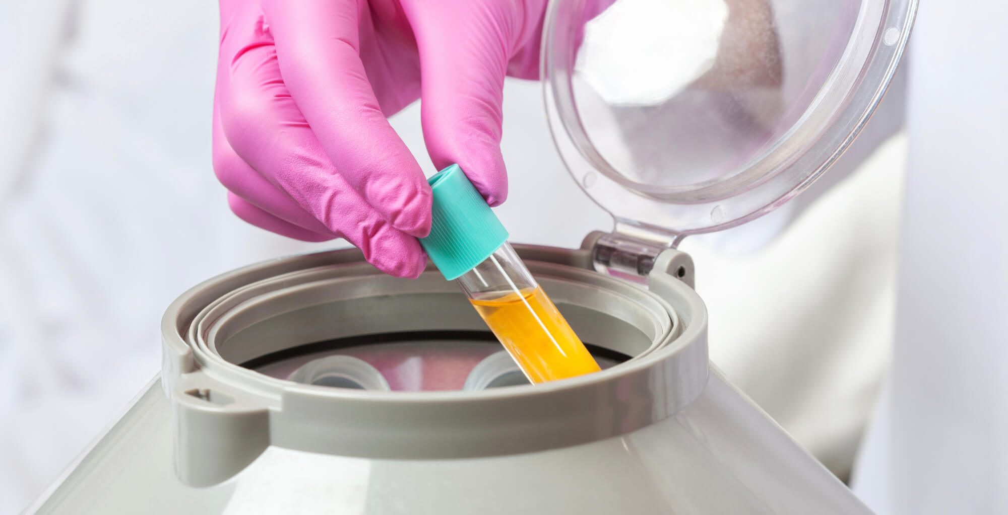 Hier sieht man Tools und Substanzen für die PRP Therapie, eine Anti-Aging Behandlung von Dermacare Wien.