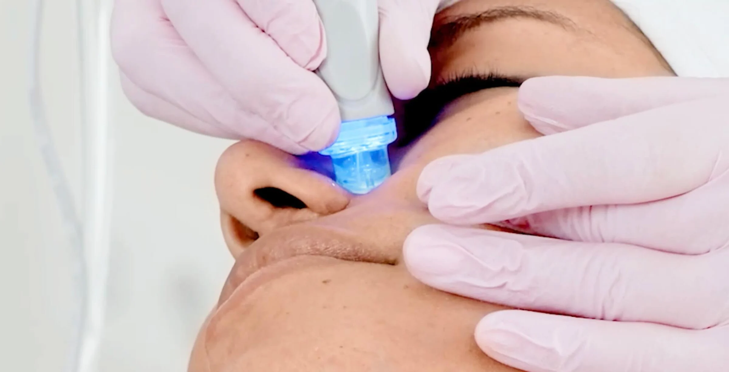 Aquafacial vs Hydrafacial – Welche Behandlung passt zu Ihrer Haut?