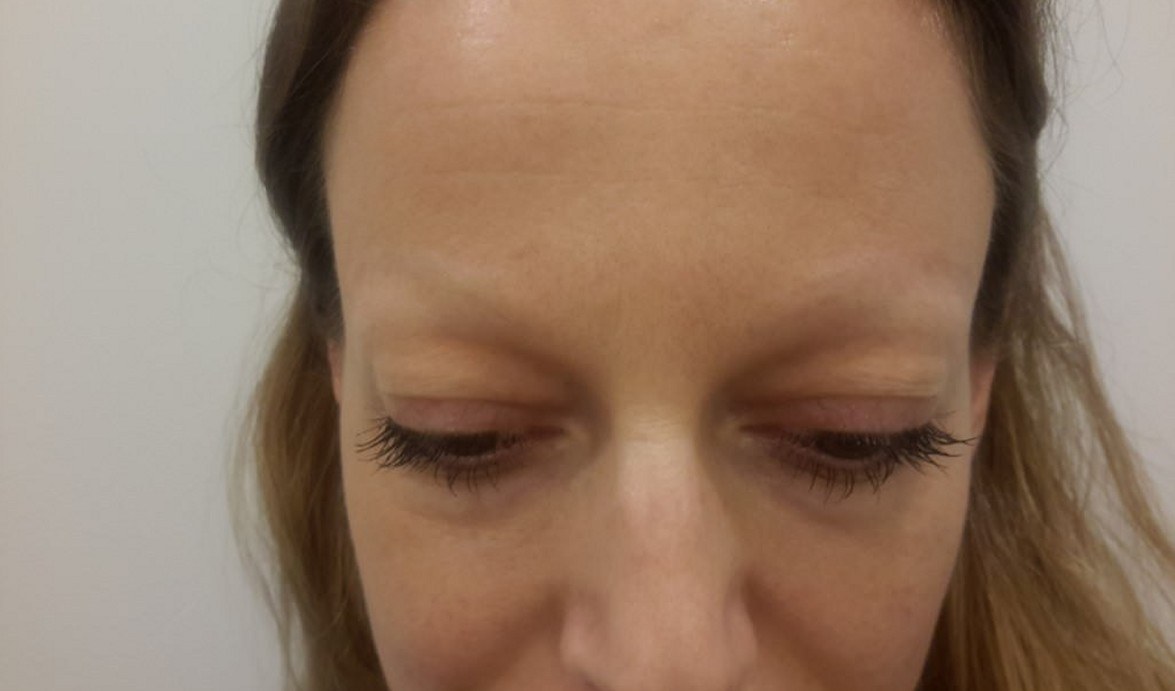 Colour change treatment before & after — after