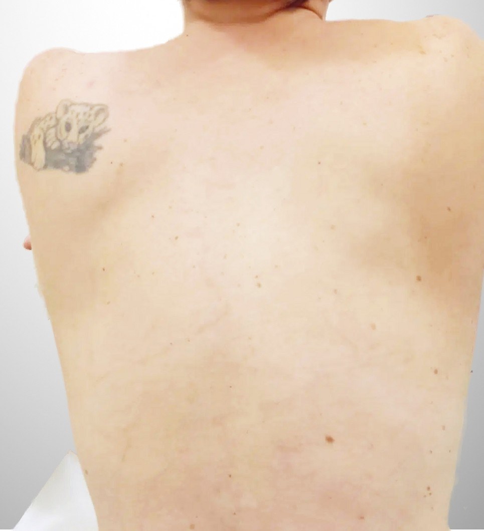 Tattoo Drache am Rücken — nachher
