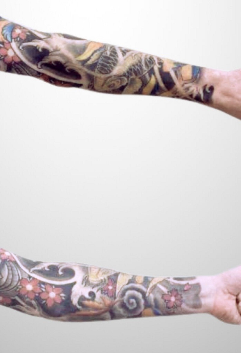 Tattooentfernung (Cover-up) Unterarm — nachher