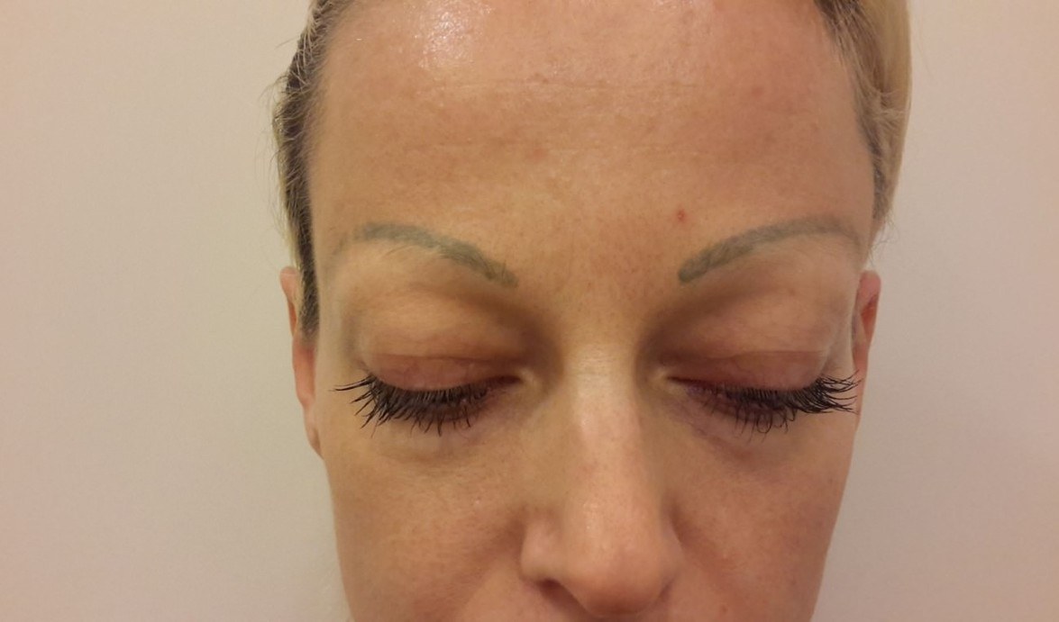 Colour change treatment before & after — before