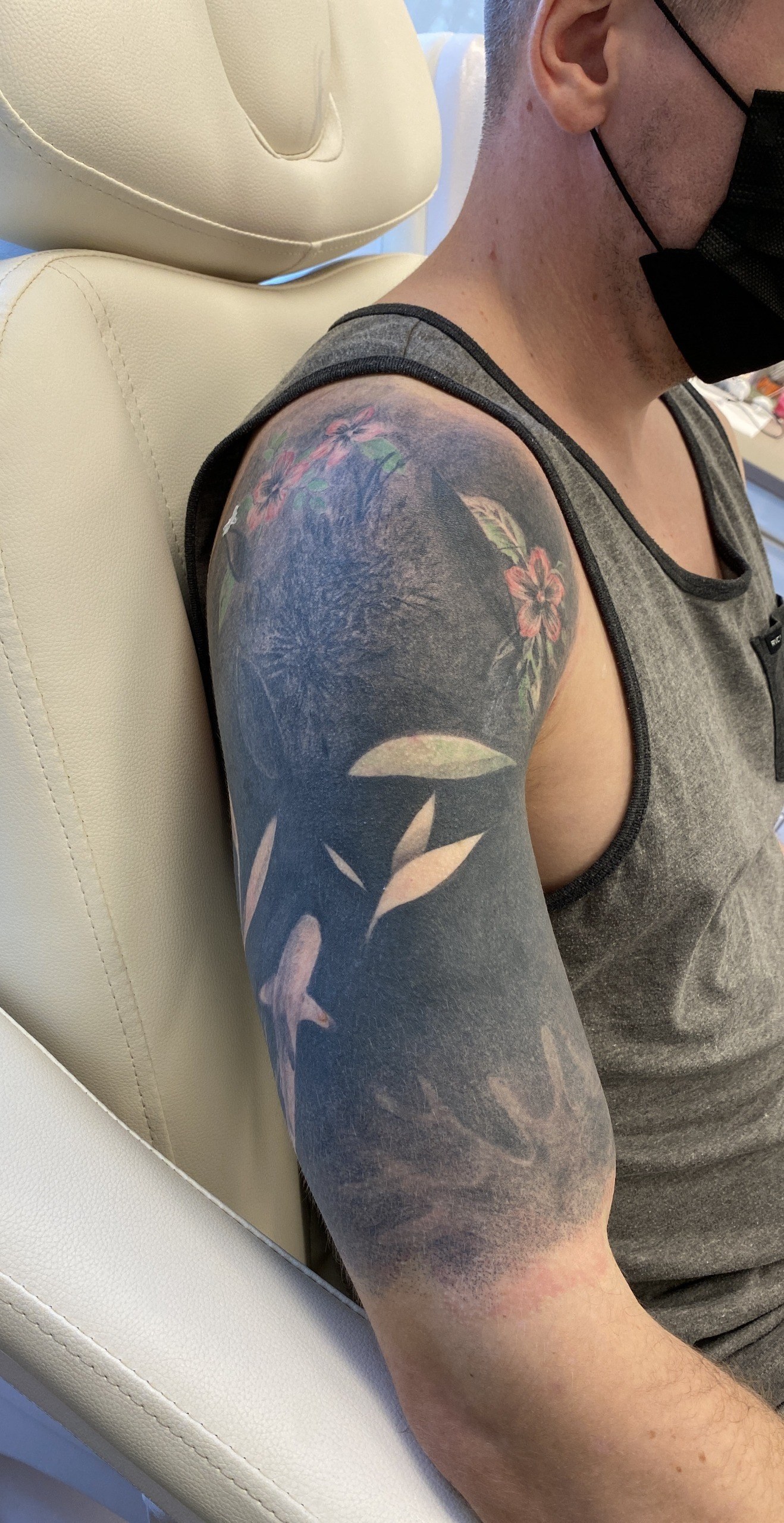Schwarzes Tattoo am Arm — vorher