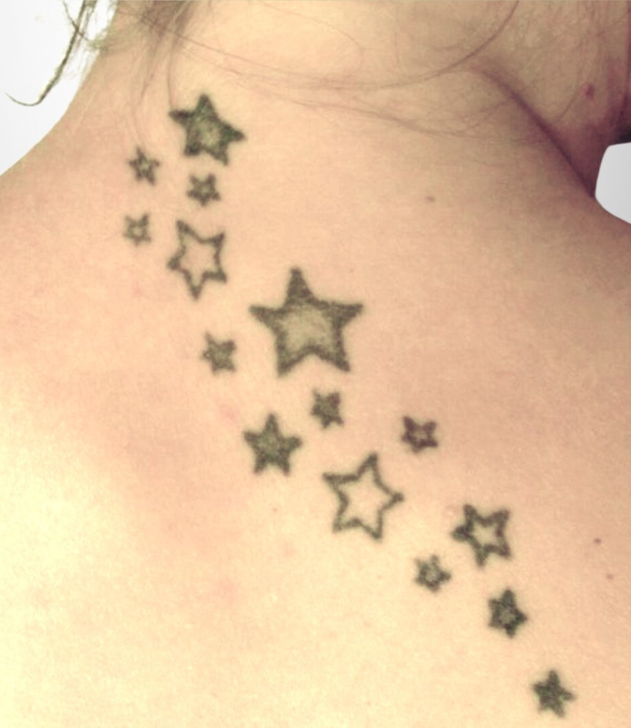 Tattooentfernung am Rücken — vorher