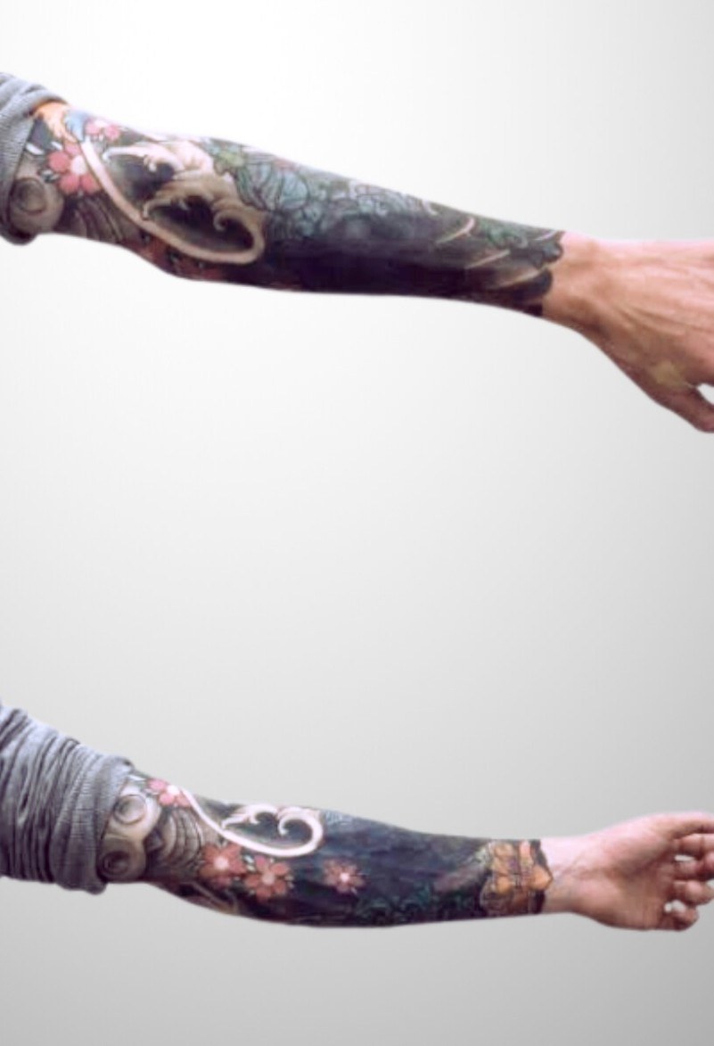 Tattooentfernung (Cover-up) Unterarm — vorher