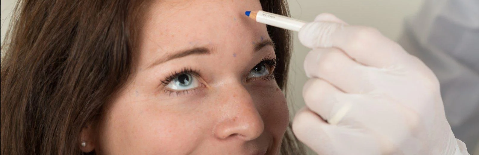 Botoxbehandlung gegen Falten bei Dermacare