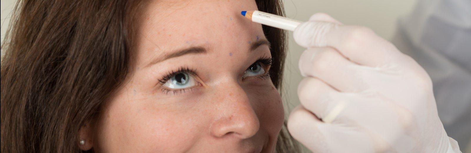 Botoxbehandlung gegen Falten bei Dermacare