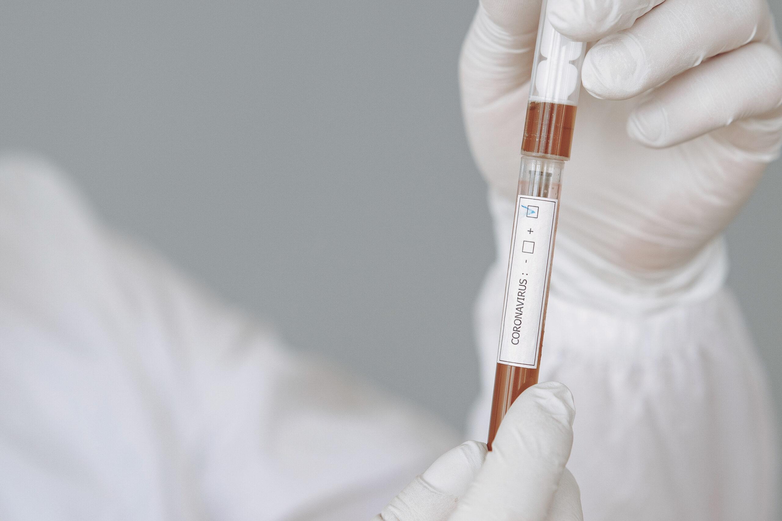 Corona Test in Wien bei Dermacare