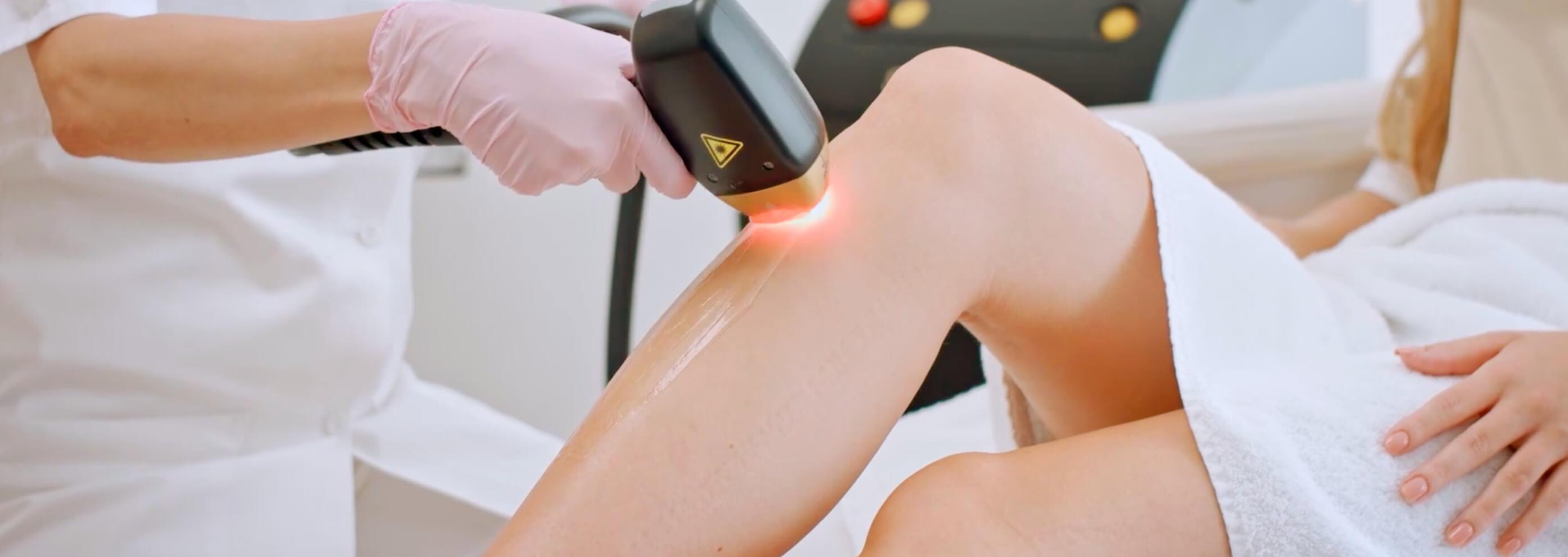 Das Bild zeigt die Haarentfernung der Beine in Wien. Eine Frau bekommt eben eine Laserhaarentfenrung bei Dermacare Wien.