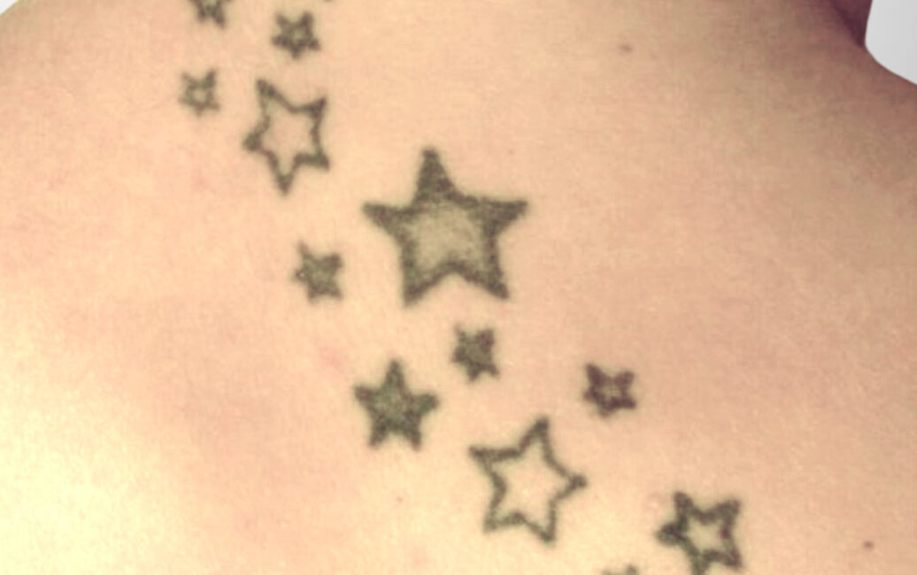 Tattoo – Klein