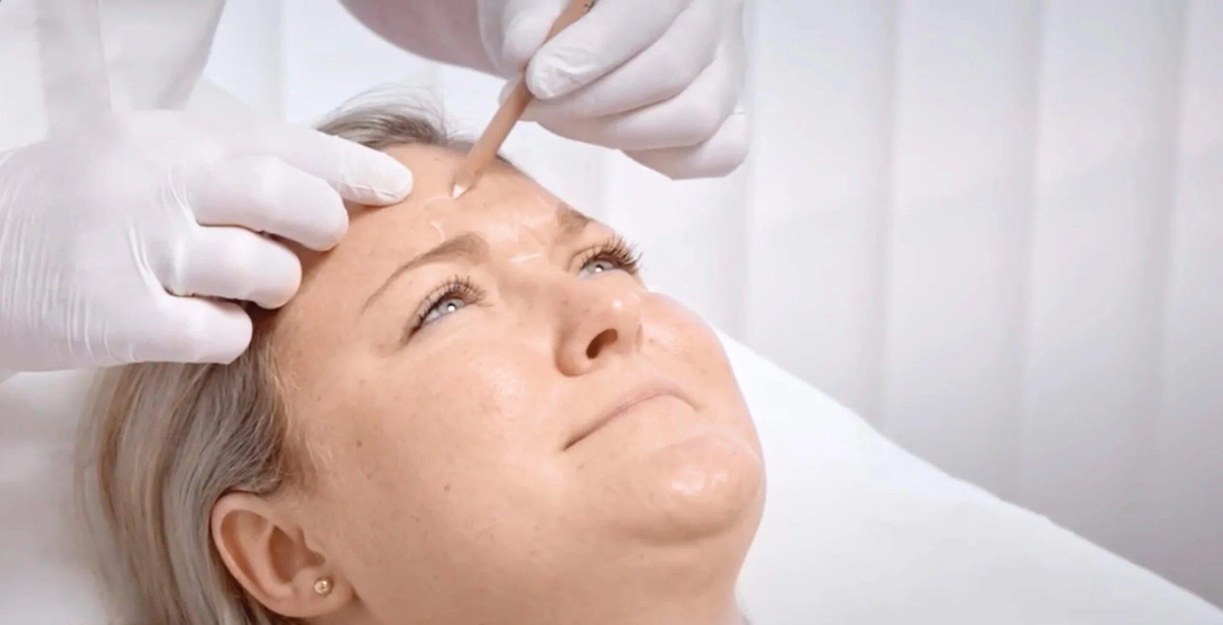 Auf dem Bild werden der Frau gerade die wichtigsten Behandlungsregionen im Gesicht für die Faltenunterspritzung mit Botox eingezeichnet. Sie möchte ihre Stirnfalten glätten.