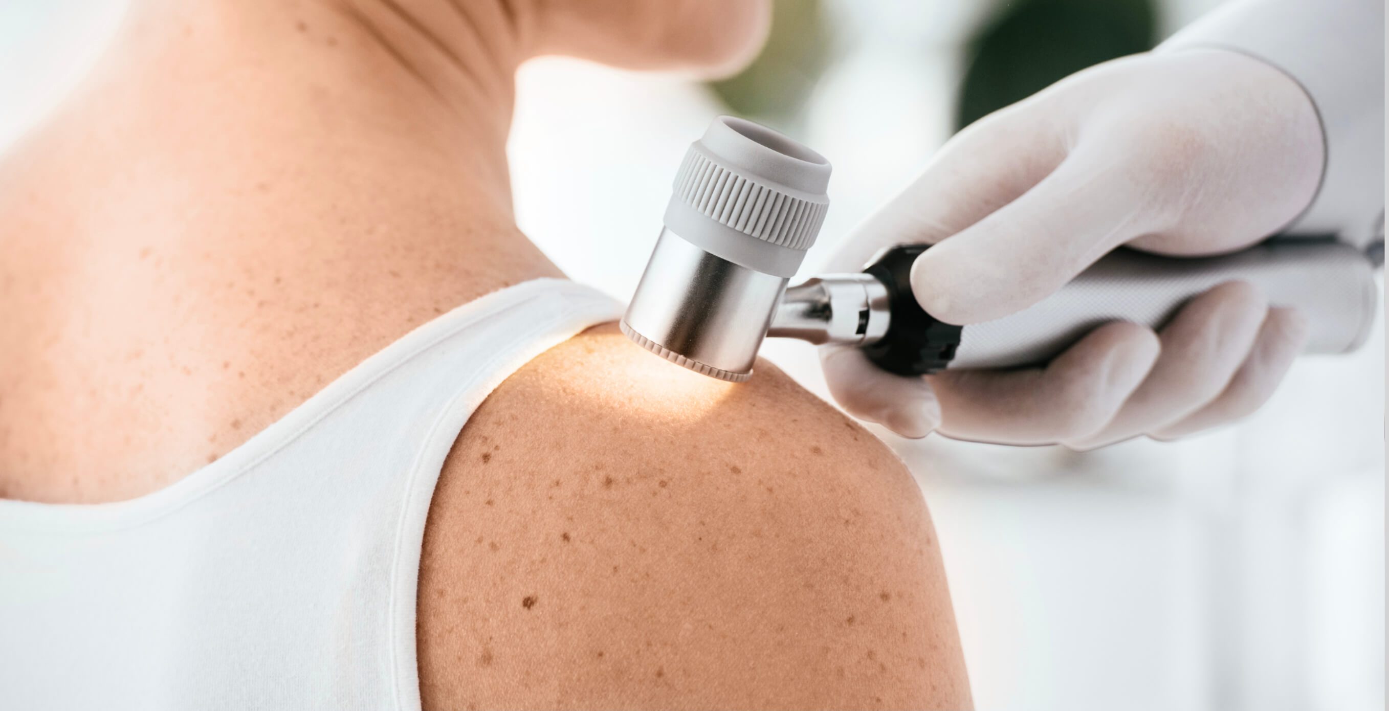 Behandlung von Pilzerkrankungen bei Dermacare Wien