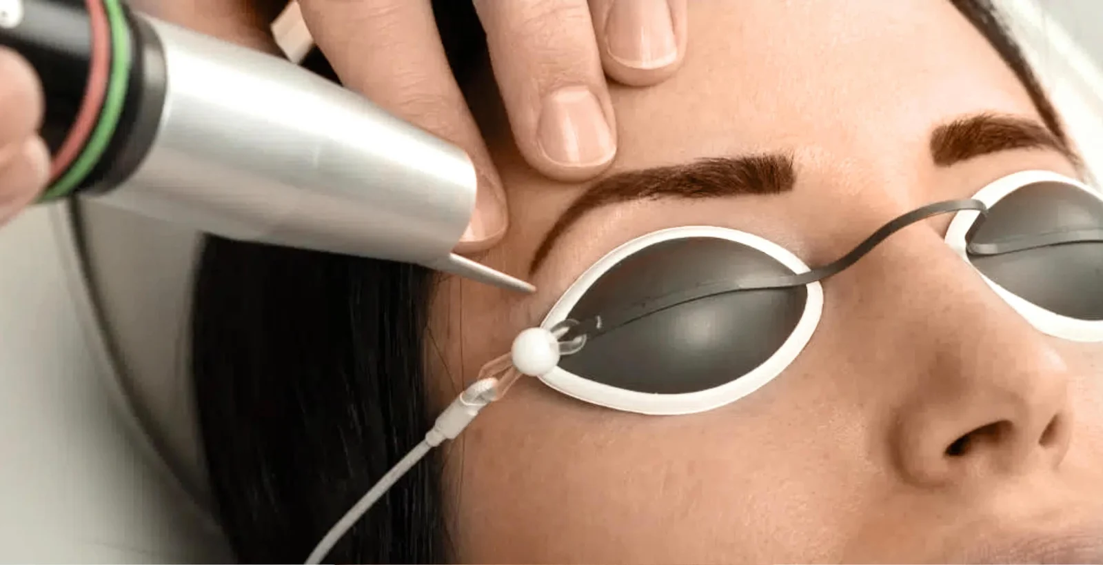 Permanent Make-Up entfernen mit Laser in Wien