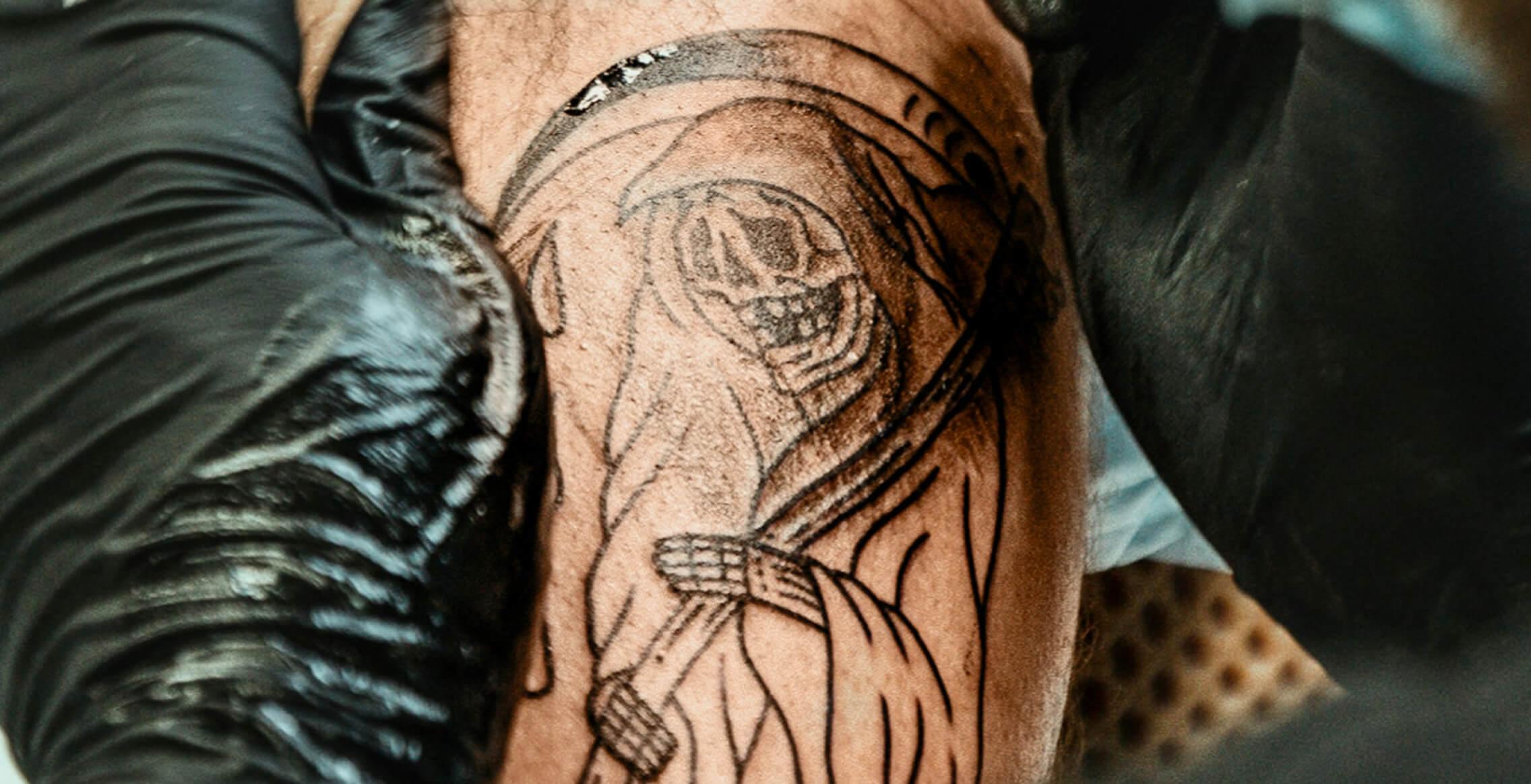 15 Jahre bereut – so konnte ich mein Tattoo loswerden